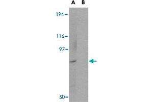 Western blot analysis of BICD1 in Daudi cell lysate with BICD1 polyclonal antibody  at 1 ug/mL in (A) the absence and (B) the presence of blocking peptide. (BICD1 antibody  (C-Term))