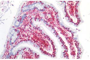 Immunohistochemistry (Paraffin-embedded Sections) (IHC (p)) image for anti-Protein tyrosine Phosphatase, Receptor Type, C (PTPRC) antibody (ABIN94127)