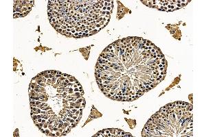 ABIN7096269 and ABIN7100331 at 1/100 staining mouse testis tissue by IHC-P. (SHCBP1L antibody)