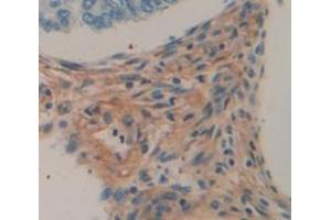 Used in DAB staining on fromalin fixed paraffin- embedded skeletal muscle tissue (Myopalladin antibody  (AA 945-1320))