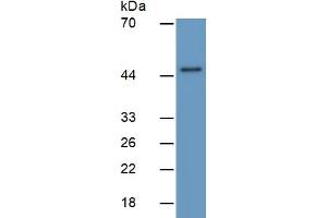 Mouse Capture antibody from the kit in WB with Positive Control: Human brain lysate.