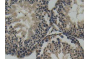 IHC-P analysis of Mouse Testis Tissue, with DAB staining. (SEMA4D/CD100 antibody  (AA 502-636))
