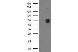 HEK293T cells were transfected with the pCMV6-ENTRY control (Left lane) or pCMV6-ENTRY BECN1 (Right lane) cDNA for 48 hrs and lysed. (Beclin 1 antibody)