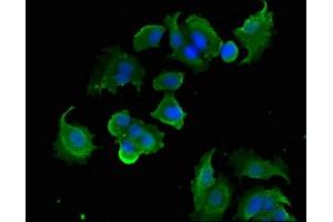 Immunofluorescent analysis of MCF-7 cells using ABIN7166448 at dilution of 1:100 and Alexa Fluor 488-congugated AffiniPure Goat Anti-Rabbit IgG(H+L) (PTK6 antibody  (AA 1-113))