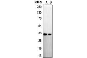 Western blot analysis of STEAP1 expression in LNCaP (A), A431 (B) whole cell lysates.