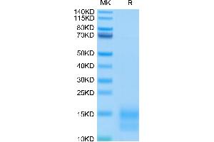 Mouse BCMA/TNFRSF17 on Tris-Bis PAGE under reduced condition. (BCMA Protein (AA 1-49) (His-Avi Tag))