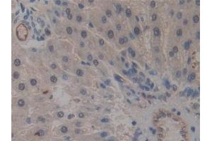 Detection of ICAM2 in Rat Liver Tissue using Polyclonal Antibody to Intercellular Adhesion Molecule 2 (ICAM2) (ICAM2 antibody  (AA 29-247))