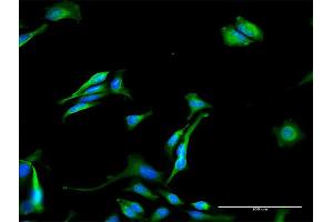 Immunofluorescence of purified MaxPab antibody to GNPAT on HeLa cell.