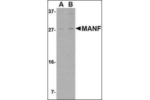 Western blot analysis of MANF in rat brain tissue lysate with this product at (A) 1 and (B) 2 μg/ml. (MANF antibody  (N-Term))
