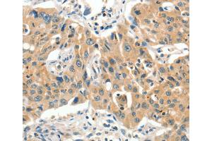 Immunohistochemistry (IHC) image for anti-Solute Carrier Family 11 (Proton-Coupled Divalent Metal Ion Transporters), Member 2 (SLC11A2) antibody (ABIN2432955) (SLC11A2 antibody)