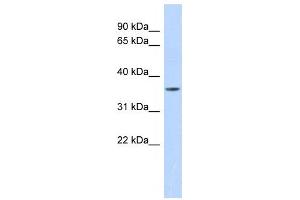Western Blotting (WB) image for anti-Matrix Metallopeptidase 23B (MMP23B) antibody (ABIN2459052) (MMP23B antibody)