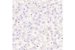 Immunohistochemistry analysis of paraffin-embedded rat hepatitis using,Tal1 (ABIN7075819) at dilution of 1: 1500 (TAL1 antibody)