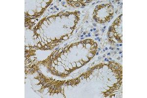 Immunohistochemistry of paraffin-embedded human stomach using SIGMAR1 antibody. (SIGMAR1 antibody)