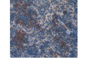 IHC-P analysis of Rat Spleen Tissue, with DAB staining. (KIT antibody)