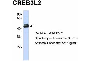 Host:  Rabbit  Target Name:  CREB3L2  Sample Type:  Human Fetal Brain  Antibody Dilution:  1. (CREB3L2 antibody  (N-Term))