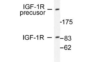 Image no. 1 for anti-Insulin-Like Growth Factor 1 Receptor (IGF1R) antibody (ABIN265476)