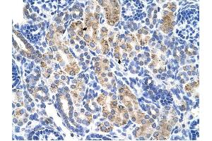 ALDH3A2 antibody was used for immunohistochemistry at a concentration of 4-8 ug/ml to stain Epithelial cells of renal tubule (arrows) in Human Kidney. (ALDH3A2 antibody  (C-Term))