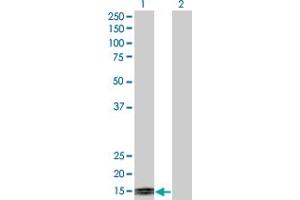Western Blot analysis of TFF1 expression in transfected 293T cell line by TFF1 monoclonal antibody (M04), clone M2. (TFF1 antibody  (AA 1-84))