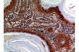 Immunohistochemistry (IHC) analysis of paraffin-embedded Human Skin, antibody was diluted at 1:100. (CCL27 antibody)