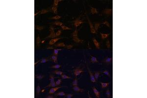 Immunofluorescence analysis of C6 cells using R antibody (ABIN6128592, ABIN6146556, ABIN6146557 and ABIN6215667) at dilution of 1:100. (RAB21 antibody  (AA 1-225))