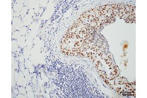 Immunohistochemistry analysis using Rat Anti-HSF1 Monoclonal Antibody, Clone 4B4 . (HSF1 antibody  (AA 425-439) (HRP))