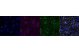 Immunohistochemistry (IHC) image for anti-Ubiquitin Carboxyl-terminal Esterase L1 (Ubiquitin Thiolesterase) (UCHL1) antibody (ABIN7456137) (UCHL1 antibody)