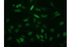 Image no. 4 for anti-Chromosome 2 Open Reading Frame 40 (C2orf40) antibody (ABIN1497047) (C2orf40 antibody)