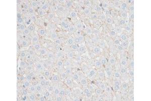 Immunohistochemistry of paraffin-embedded Rat liver using N-Cadherin Polyclonal Antibody at dilution of 1:100 (40x lens). (N-Cadherin antibody)