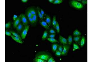 Immunofluorescent analysis of HepG2 cells using ABIN7174352 at dilution of 1:100 and Alexa Fluor 488-congugated AffiniPure Goat Anti-Rabbit IgG(H+L) (USP6 antibody  (C-Term))