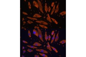 Immunofluorescence analysis of H9C2 cells using CD172a/SIRPα Rabbit pAb (ABIN6130058, ABIN6147780, ABIN6147781 and ABIN6224854) at dilution of 1:100 (40x lens). (SIRPA antibody  (AA 395-504))