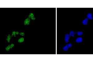 HeLa cells were fixed in paraformaldehyde, permeabilized with 0. (H2AFZ antibody)