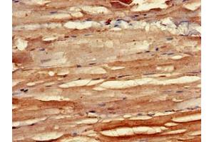 Immunohistochemistry of paraffin-embedded human skeletal muscle tissue using ABIN7145708 at dilution of 1:100 (BMPR1B antibody  (AA 14-126))