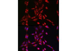 Immunofluorescence analysis of NIH/3T3 cells using PIK3R4/VPS15 Rabbit pAb (ABIN7269323) at dilution of 1:50 (40x lens). (PIK3R4 antibody  (AA 1-330))