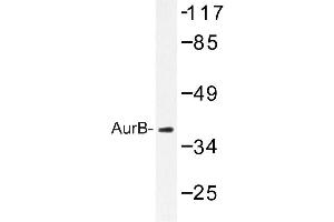 Image no. 1 for anti-Aurora Kinase B (AURKB) antibody (ABIN272096) (Aurora Kinase B antibody)