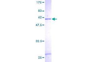 SULT1C2 Protein (AA 1-296) (GST tag)