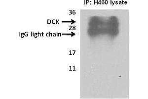 Deoxycytidine kinase(DCK) immunoprecipitated from H460cells with 7. (DCK antibody  (C-Term))