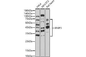 Western blot analysis of extracts of various cell lines, using BNIP3 antibody (ABIN6127502, ABIN6137620, ABIN6137621 and ABIN6221337) at 1:1000 dilution. (BNIP3 antibody  (AA 1-164))