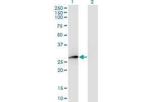 Western Blot analysis of HPGD expression in transfected 293T cell line by HPGD monoclonal antibody (M01), clone 1D8. (HPGD antibody  (AA 1-266))