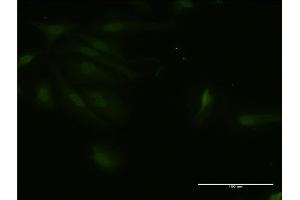 Immunofluorescence of monoclonal antibody to RNF125 on HeLa cell.