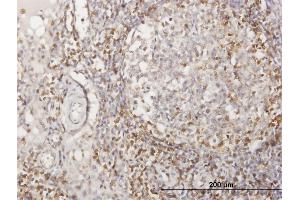 Immunoperoxidase of purified MaxPab antibody to CD2 on formalin-fixed paraffin-embedded human lymph node. (CD2 antibody  (AA 1-351))