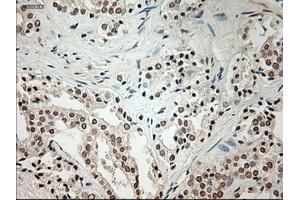 Immunohistochemical staining of paraffin-embedded Ovary tissue using anti-L1CAMmouse monoclonal antibody.