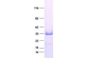 Western Blotting (WB) image for Zinc Finger, AN1-Type Domain 5 (ZFAND5) protein (DYKDDDDK Tag) (ABIN2735748)