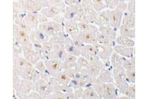 Immunohistochemical staining of DcR3 in human heart tissue with DcR3 antibody at 1μg/ml. (TNFRSF6B antibody)