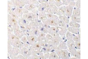 Immunohistochemical staining of DcR3 in human heart tissue with DcR3 antibody at 1μg/ml.