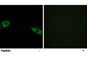 Immunofluorescence analysis of HUVEC cells, using RPS4Y1 polyclonal antibody . (RPS4Y1 antibody  (C-Term))