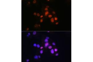 Immunofluorescence analysis of Hep G2 cells using HNF3β/HNF3β/FOX Rabbit mAb (ABIN7267232) at dilution of 1:100 (40x lens). (FOXA2 antibody)