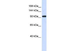 WB Suggested Anti-ZNF452 Antibody Titration:  0. (SCAND3 antibody  (N-Term))