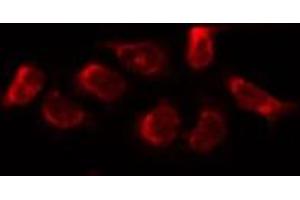 ABIN6269021 staining HUVEC by IF/ICC. (FSHR antibody  (Internal Region))