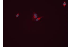 ABIN6261999 and ABIN6277813 staining HEPG2 cells by ICC/IF. (GLN1 antibody  (C-Term))