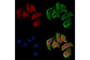 ABIN7094256 and ABIN7098303 staining HepG2 cells by IF/ICC. (GINS3 antibody  (Internal Region))